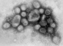 Un virus ou un vaccin qui vous fera crever dans d'atroces souffrances.